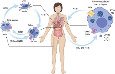 The Iron Curtain: Macrophages at the Interface of Systemic and Microenvironmental Iron Metabolism and Immune Response in Cancer